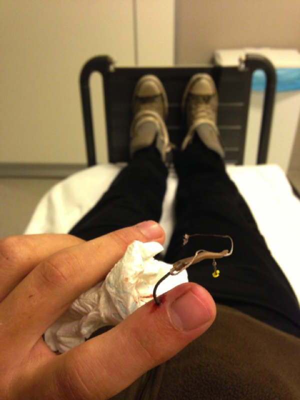 boul 31 haak wouter Scherrenberg